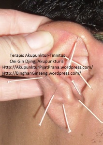 Akupunktur tinnitus oleh Oei Gin Djing, Akupunkturis